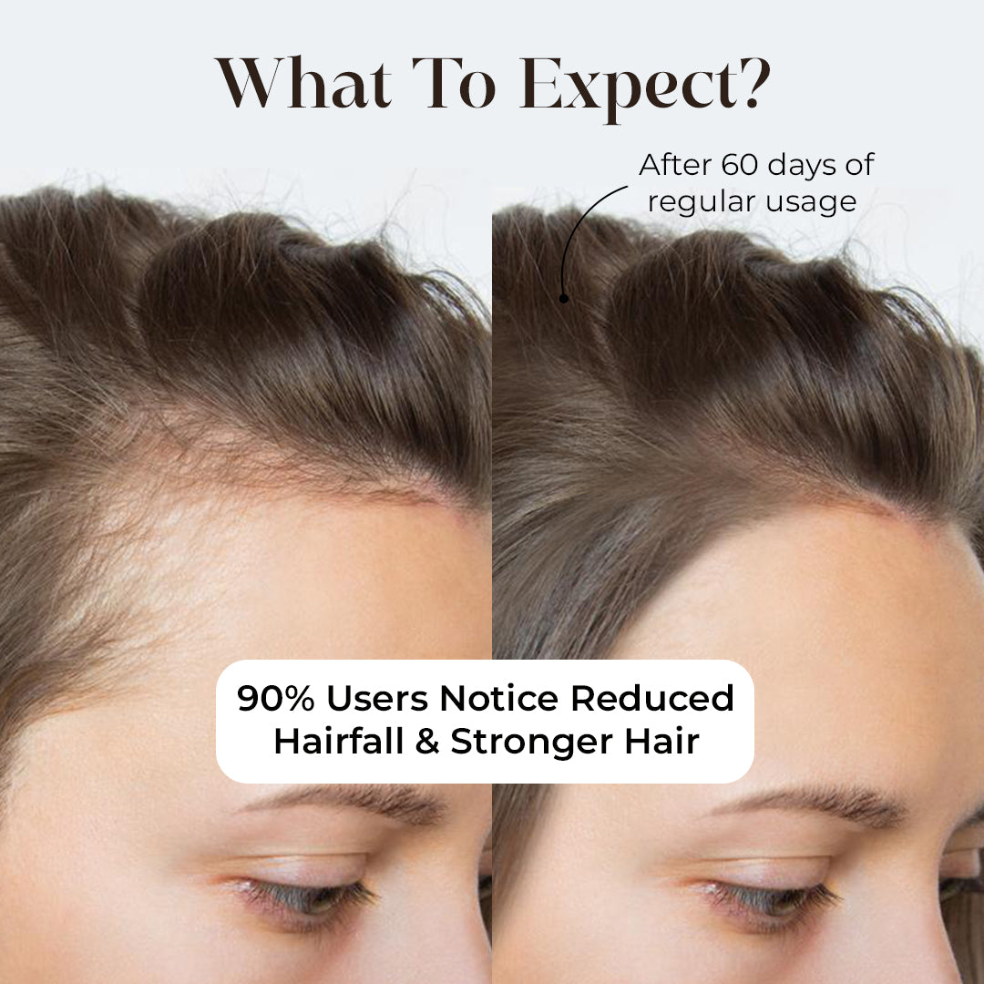 gummy hair, biotin gummies for hair,
biotin gummies, hair growth gummies, hair gummies,
hair gummies for women,
multivitamin gummies, biotin hair gummies, skin gummies, gummies for hair and skin, vitamin gummies